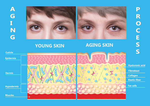 younger skin and aging skin. elastin and collagen. The younger skin and aging skin. elastin and collagen. A diagram of young and old face showing the decrease in collagen and broken elastin. skin diagram photos stock pictures, royalty-free photos & images
