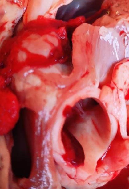 сердце свиньи, анатомия, орган - human artery animal artery human heart blood стоковые фото и изображения