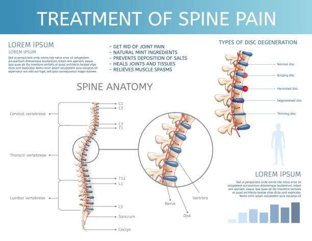 Vector Treatment of Spine Pain. Spine Anatomy. Vector Illustration Treatment of Spine Pain. Spine Anatomy. Square Flat Banner on White Background. Graphic Spinal Diagram Showing Cervical Vertebrae Below Pectoral and Lumbar Spine. spinal surgery recovery stock illustrations