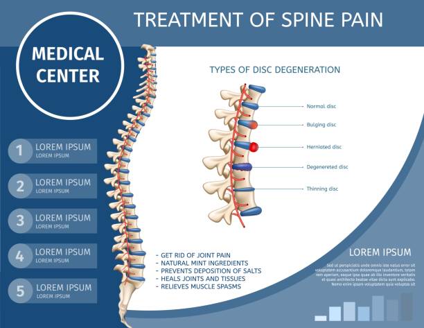 illustrations, cliparts, dessins animés et icônes de traitement de la colonne vertébrale douleur médical plat bannière. - dégénératif