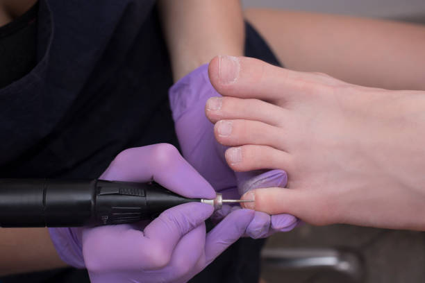 istock Processing toenails, pedicure. Gloved hands with a pedicure cutter. Close-up 1132032061