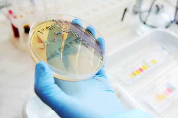 istock Petri dishes in the laboratory 1132249566