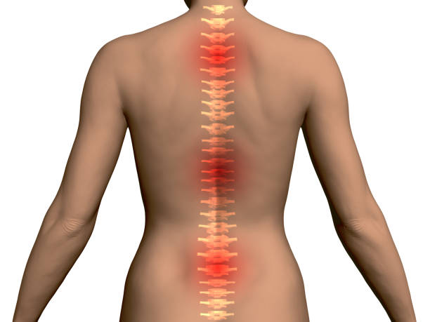 ilustrações de stock, clip art, desenhos animados e ícones de back of the girl with the spine and red areas - rear view human arm naked men