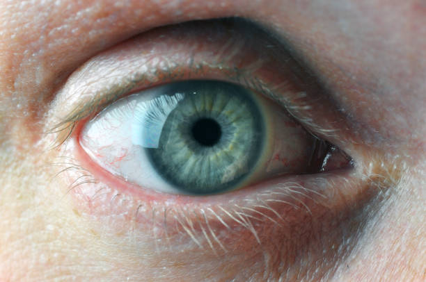 istock Eye with contact lens. 1132281589