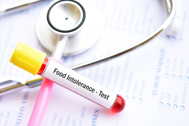 Food intolerance test Test tube with blood sample for food intolerance test fish blood stock pictures, royalty-free photos & images