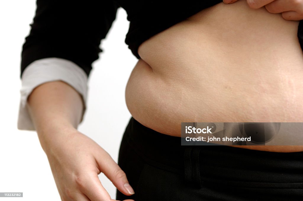 Obèse chers exposé ventre avec vergetures - Photo de Adulte libre de droits