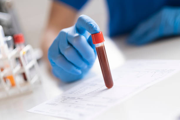 il diagnostico sta facendo un esame del campione di sangue. - blood red blood cell blood cell blood sample foto e immagini stock