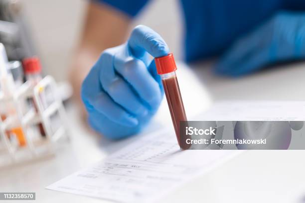 Diagnostician Is Doing A Blood Sample Test Stock Photo - Download Image Now - Blood Test, Medical Test, Blood