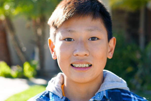 istock Portrait of young Asian kid boy with tooth braces. 1132425983