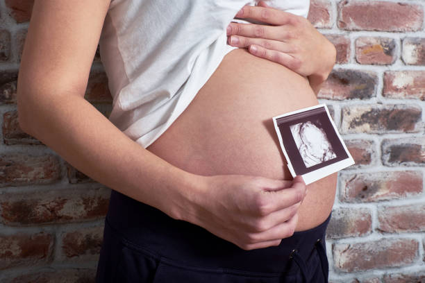 Pregnant woman holding a photo with ultrasound showing baby Pregnant woman holding a photo with ultrasound showing baby Post-Birth Paternity Declaration stock pictures, royalty-free photos & images genetic testing voluntarily establish paternity