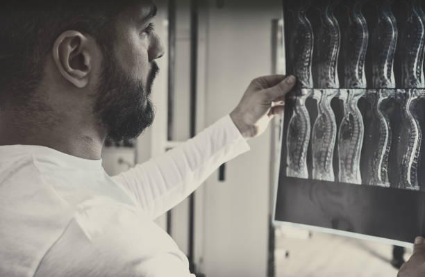 istock Radiologist watching X-ray image of spine 1132474609
