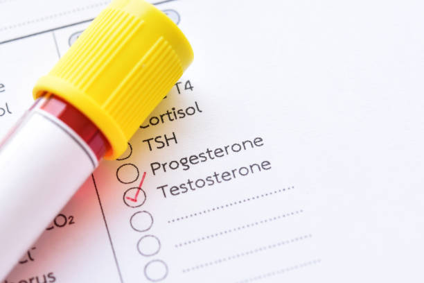 Blood for testosterone hormone test stock photo