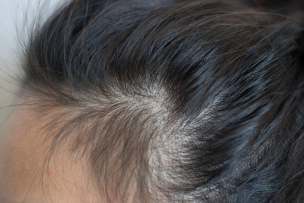 istock Head of a woman 1132641227
