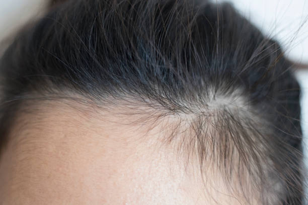 istock Head of a woman 1132641234