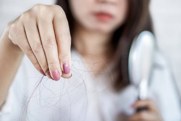 woman hand holding hair fall on comb