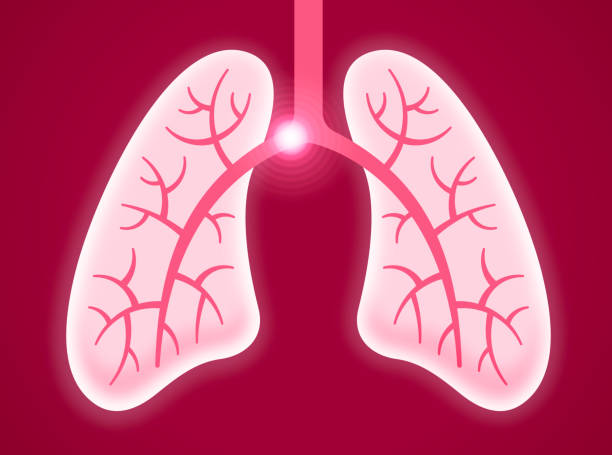 ilustrações, clipart, desenhos animados e ícones de pulmões humanos do embolismo pulmonar - inhaling human lung problems anatomy