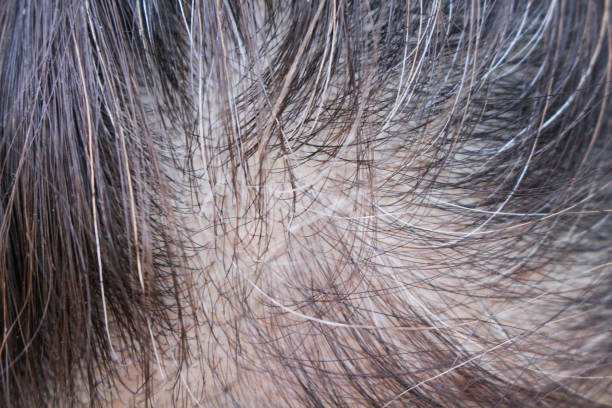 istock Top view  asian woman head has started to going gray 1133014410