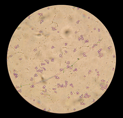 Online repositories of scanning electron microscope photographs? Fotografía micr
