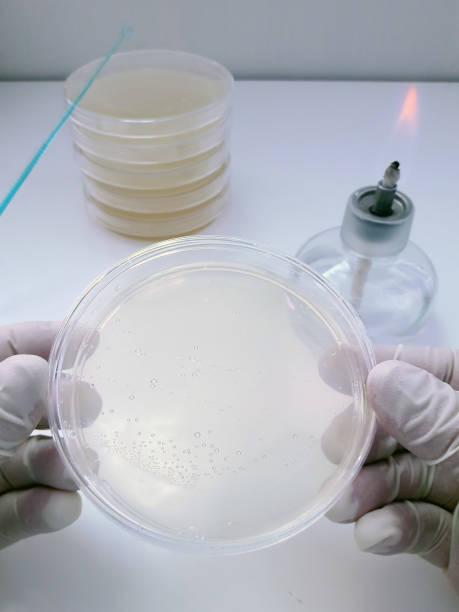 istock A tool used for sowing biological material on a Petri dish in a bacteriological laboratory 1133336019