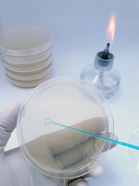 istock A tool used for sowing biological material on a Petri dish in a bacteriological laboratory 1133336086