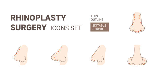 rhinoplasy пластической хирургии значки набор с редактируемым инсульта - nose job illustrations stock illustrations