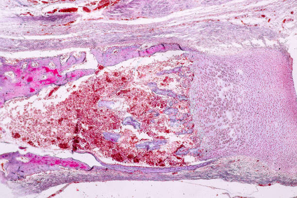 istock Study Histology of human, tissue bone under the microscopic in laboratory. 1133573792