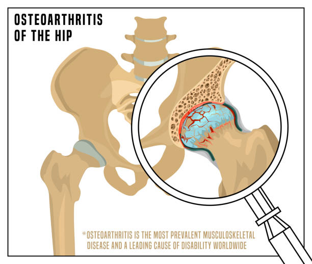 ilustrações, clipart, desenhos animados e ícones de hip osteoartrite imagem - back rear view low section pain