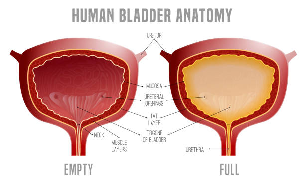 Bladder Anatomy scheme Full and empty Urinary bladder. Human organ anatomy. Editable vector illustration in realistic style isolated on white background. Medical, healthcare and scientific concept. Educational infographic bladder stock illustrations