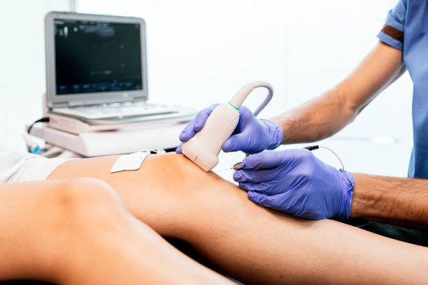 physiotherapist giving knee therapy to a woman - ultrasound imagens e fotografias de stock