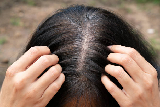 istock Young woman shows her gray hair roots 1133607111