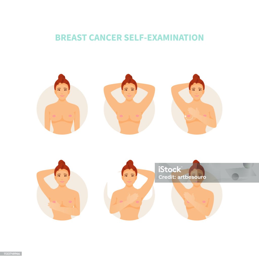 Autoexamen del cáncer de mama - arte vectorial de Seno libre de derechos