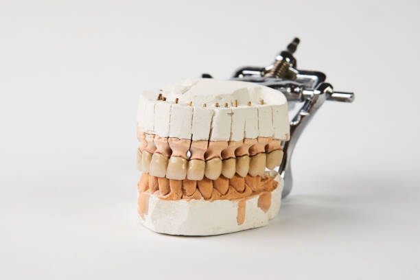 istock Gypsum Dentures with porcelain teeth isolated on white backgroun 1133851692