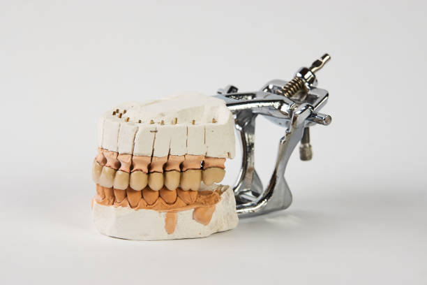 istock Gypsum Dentures with porcelain teeth isolated on white backgroun 1133851702