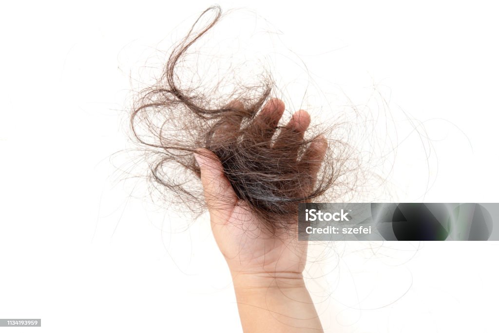 Hair Loss Problem Stock Photo - Download Image Now - Alopecia, Child,  Cancer - Illness - iStock