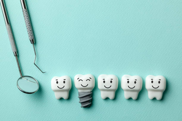 istock Healthy white teeth and implants are smiling on green mint background and dentist tools mirror, hook. 1134420482