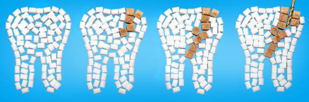 от кареев повреждены зубы от сахара на синем фоне - dentist office audio стоковые фото и изображения