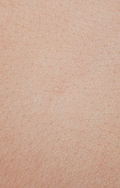 istock One pimple on human skin 1134599403