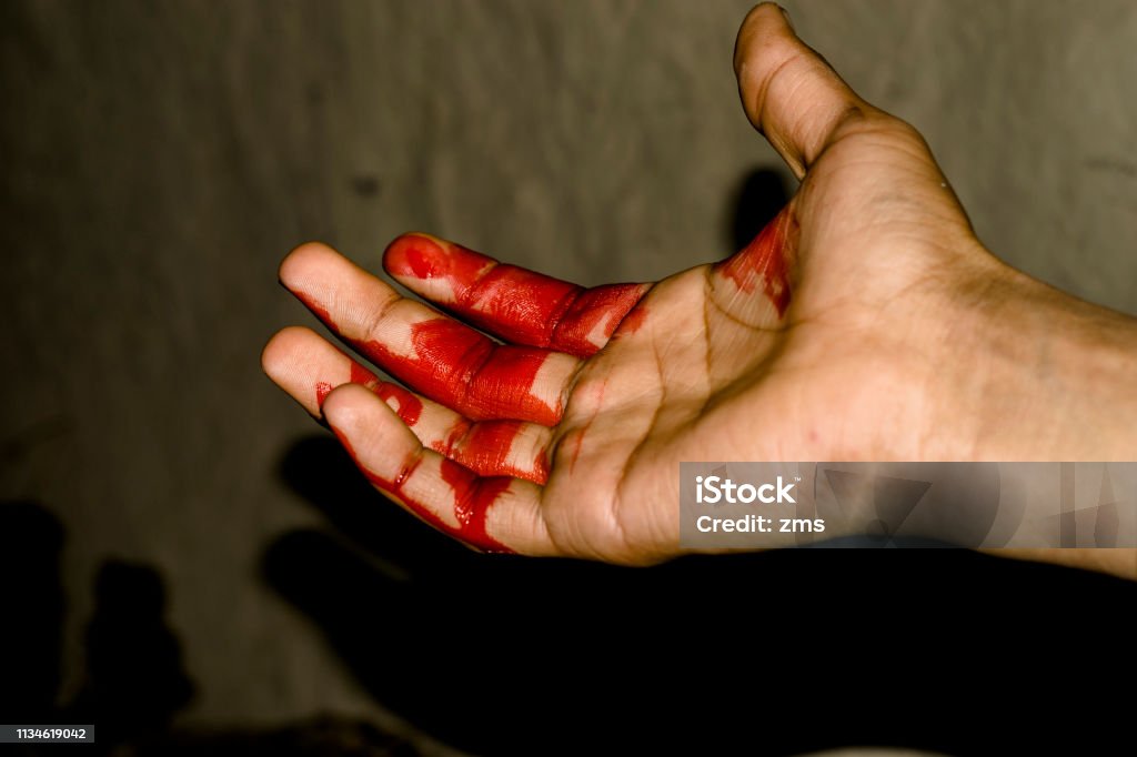 một bàn tay chảy huyết nặng trĩu và nền tối - Trả phí Bản quyền Một đợt Bác sĩ Bức hình họa sẵn có