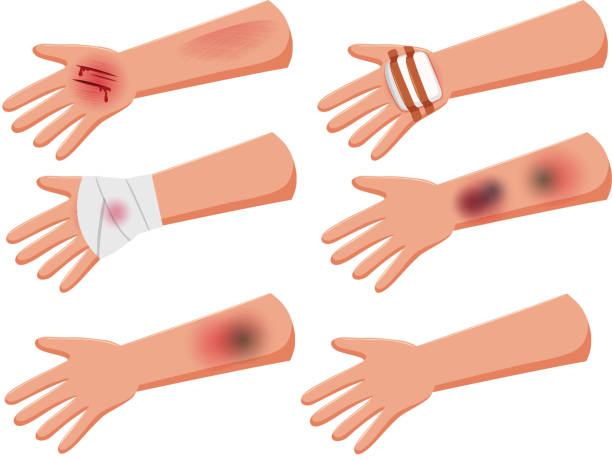 11,477 Hand Injury Illustrations & Clip Art - iStock | Worker with hand  injury, Hand injury icon, Worker hand injury