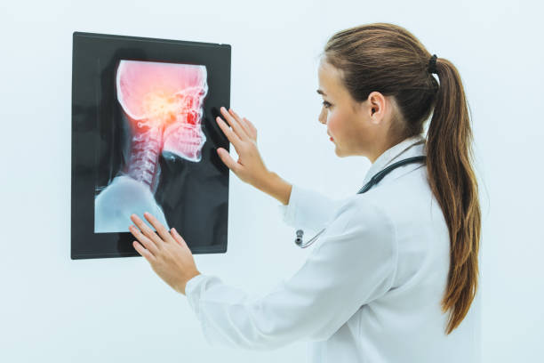 Female doctor working with x ray film of patient head and diagnose skull injury. Medical and healthcare staff service concept. stock photo