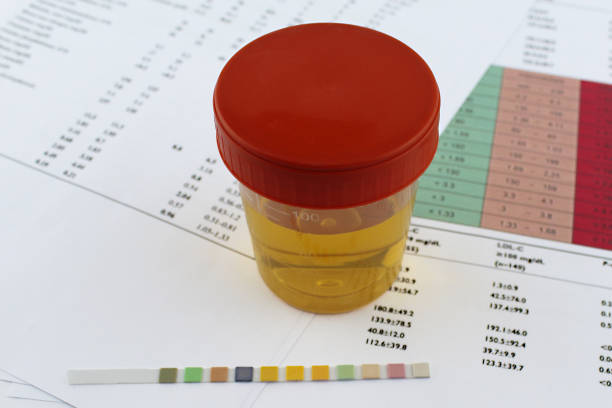 campione di test delle urine e contenitore di laboratorio - doping test foto e immagini stock