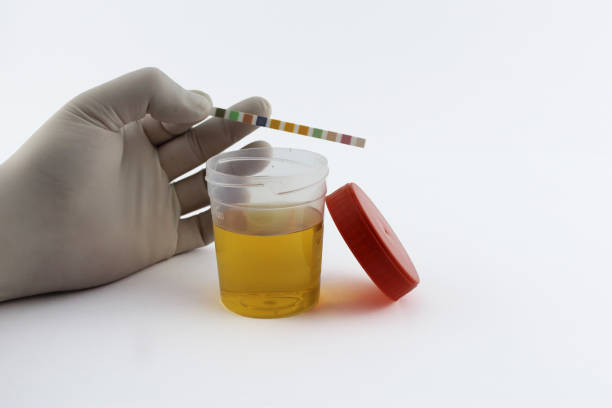 尿検査試料と実験用容器 - doping test ストックフォトと画像