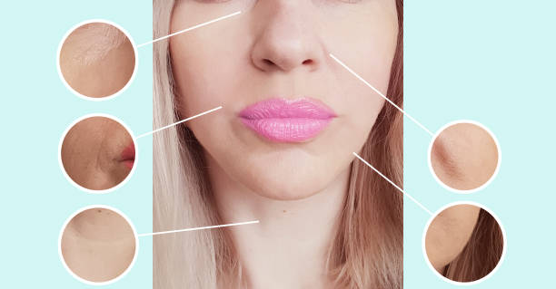 istock woman wrinkles face before and after procedures collage 1134754633