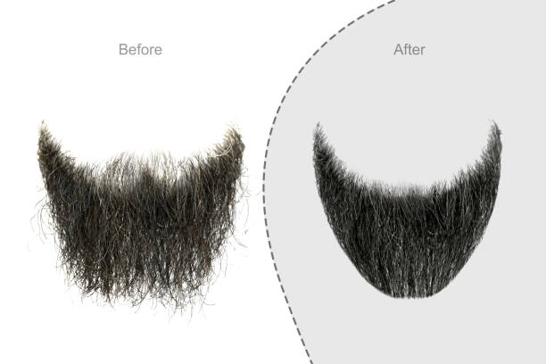istock Men's beard before and after hair salon 1134778031