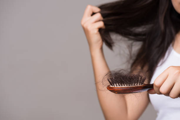 un concepto saludable. mujer mostrar su pincel con el pelo de larga pérdida y mirando su cabello. - completely bald fotografías e imágenes de stock