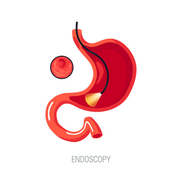endoskopie-diagnostik, vektorkonzept im flachen stil - endoskop stock-grafiken, -clipart, -cartoons und -symbole