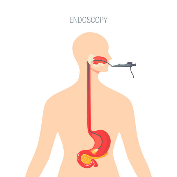 endoskopie-diagnostik, vektorkonzept im flachen stil - endoskop stock-grafiken, -clipart, -cartoons und -symbole