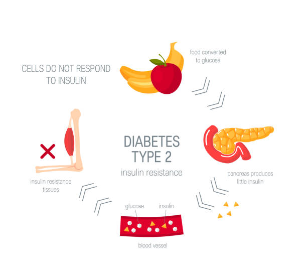 illustrazioni stock, clip art, cartoni animati e icone di tendenza di concetto di diabete di tipo 2 in stile piatto, vettore - insulin resistance