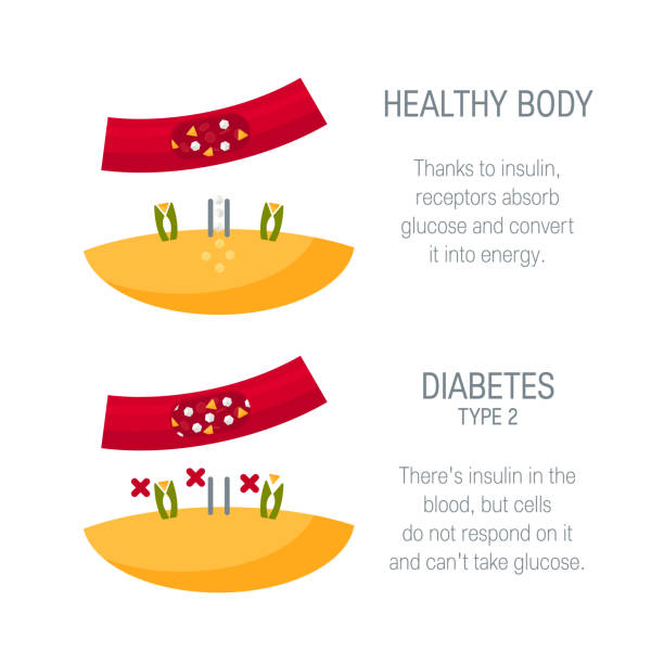 illustrazioni stock, clip art, cartoni animati e icone di tendenza di concetto di diabete di tipo 2 in stile piatto, vettore - insulin resistance