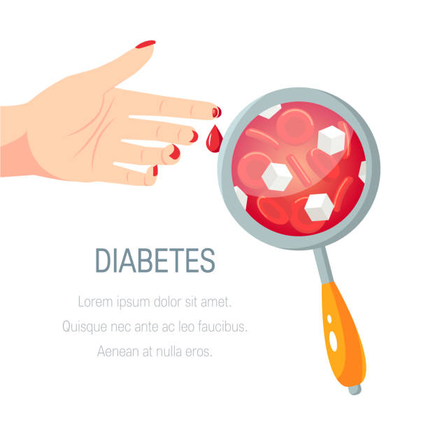 illustrations, cliparts, dessins animés et icônes de concept de diabète dans le modèle plat, conception vectorielle - hyperglycemia